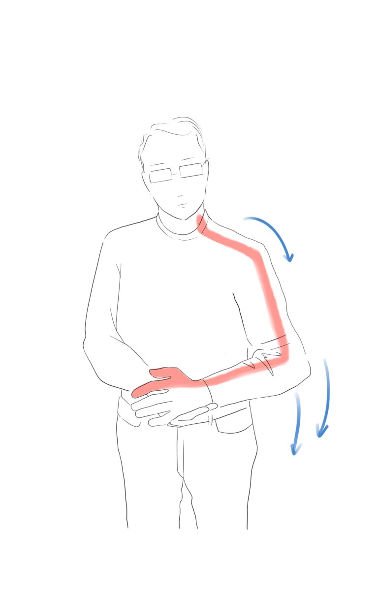 Bandscheibenvorfall HWS - Symptome, Diagnostik und Therapie
